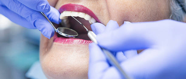 Best Emergency Wisdom Teeth Removal in Half Moon Bay, CA
