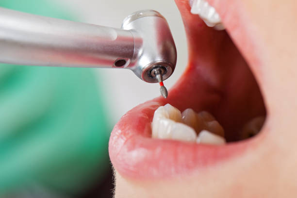 Best Pediatric Emergency Dentist in Half Moon Bay, CA